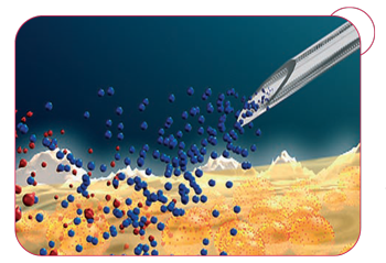 Orthokin® – systém pre individuálne prirodzené imunoproteíny priamo v mieste diania.